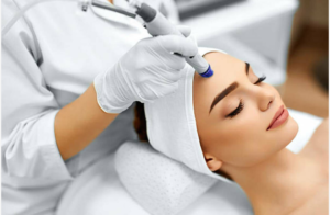 Microdermabrasion