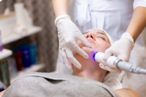 CO2 Laser Resurfacing in Delhi