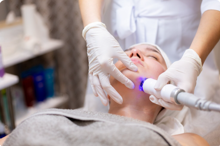 CO2 Laser Resurfacing in Delhi