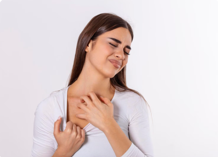 Eczema Treatment in Delhi