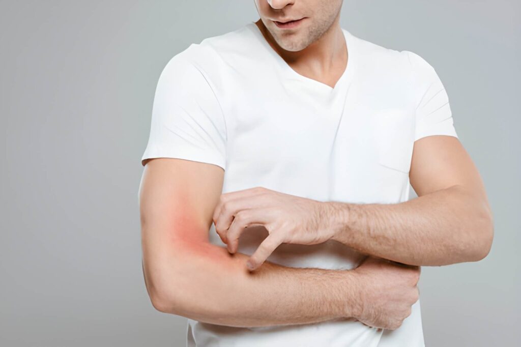 Fungal Infections Treatment in Delhi